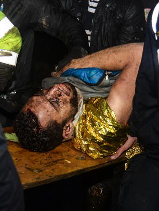 Brazil's Chapecoense player Helio Neto is helped by paramedics. Picture: AFP