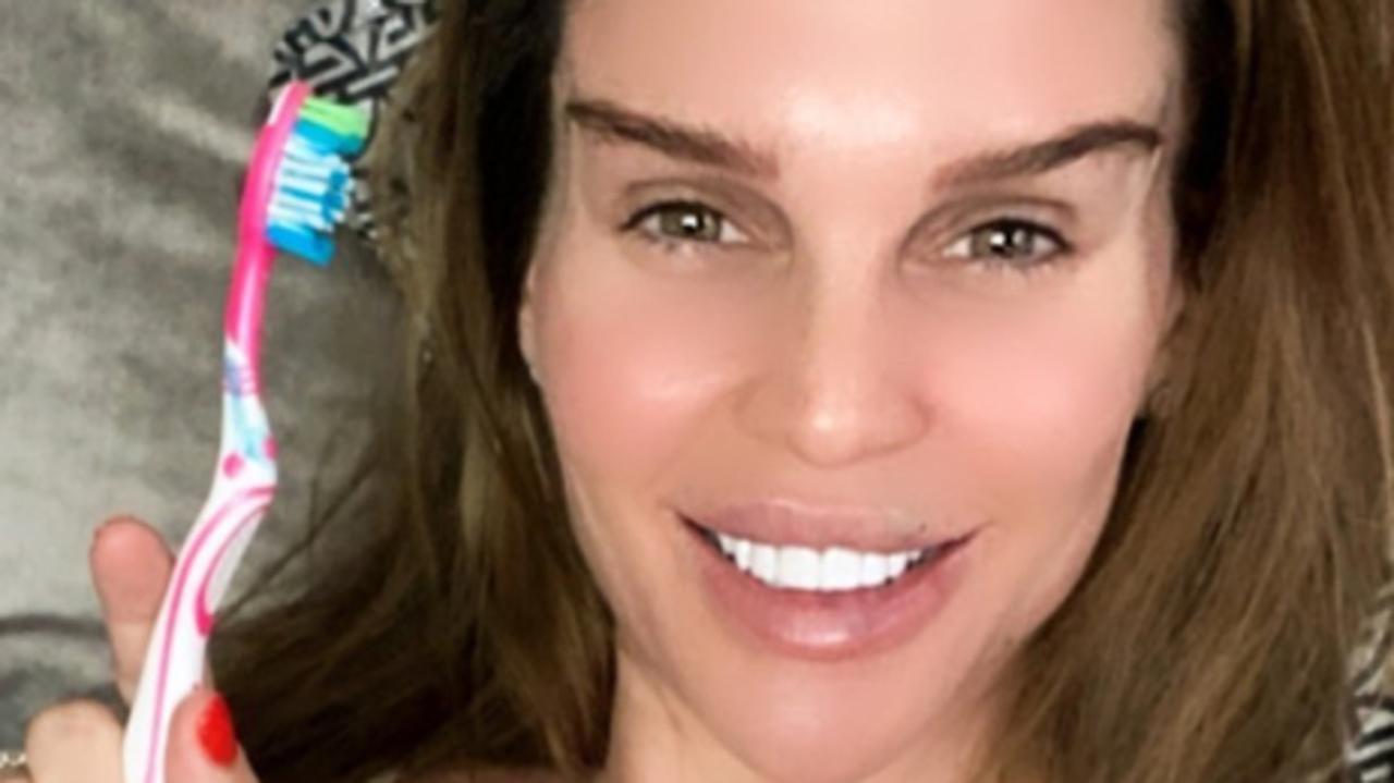 Danielle Lloyd reveals the results of her eye lift.