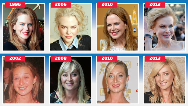 Experts tell how six Aussie celebs have managed to age with grace ...