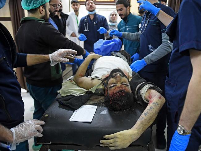 A wounded man lies at a hospital following a deadly earthquake that shook Syria at dawn in Aleppo's Salaheddine district. Picture: AFP