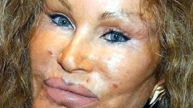 Jocelyn Wildenstein Arrested For Slashing Boyfriend In New York Apartment News Com Au Australia S Leading News Site