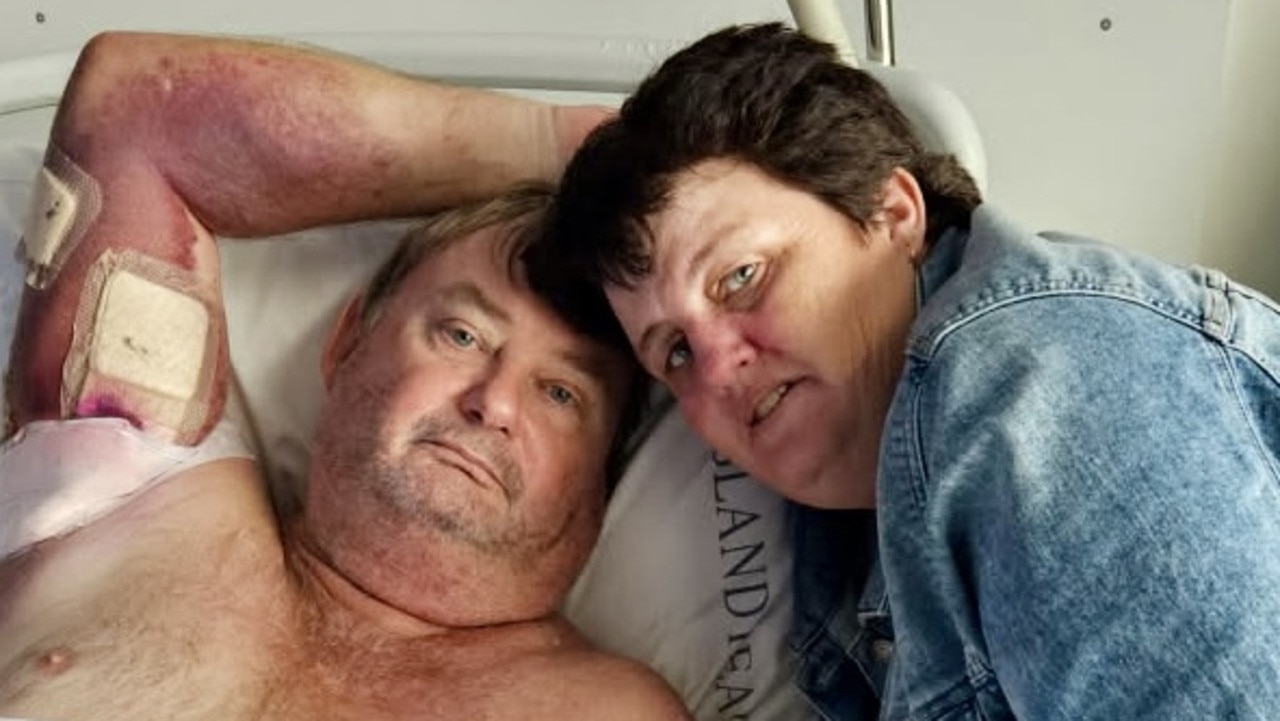 Brett and Jennifene Grant in hospital after Brett was savaged by two pig dogs.