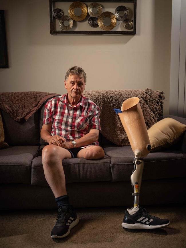 Henry Jaruga was left an amputee after a motorcyclist accident. Picture: Brad Fleet