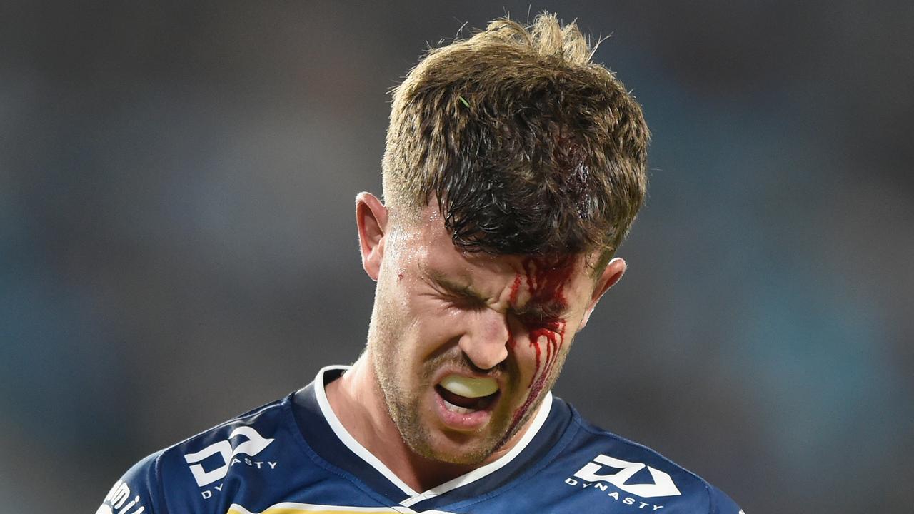 Toby Sexton suffers an injury on a dirty night for the Titans. Photo: NRL photos