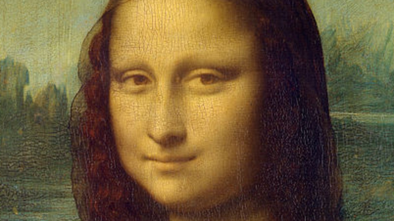 Mona Lisa: Classic Signs of Hypothyroidism in the World's Most