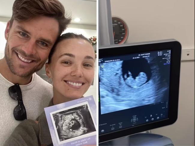 Model Brooke Hogan has announced she and her husband are expecting their first child, after a two-year struggle with IVF. Picture: Instagram