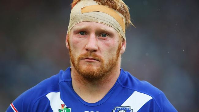 SYDNEY, AUSTRALIA - APRIL 03: James Graham of the Bulldogs looks on during the round five NRL match between the Canterbury Bulldogs and the South Sydney Rabbitohs at ANZ Stadium on April 3, 2015 in Sydney, Australia. (Photo by Brendon Thorne/Getty Images)