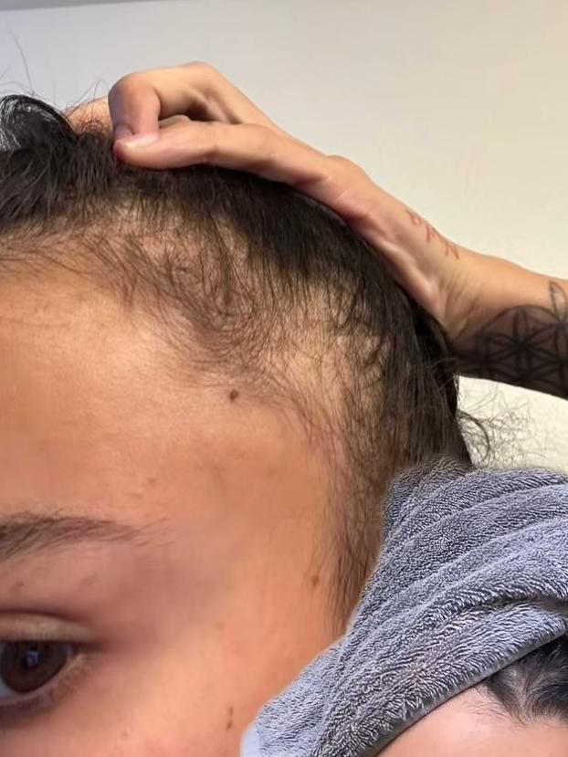 This TikTok user said that she suffered hair loss after using the products for three weeks.. Picture: TikTok.