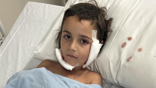 Dante, 6, in hospital after he was viciously mauled by a neighbour's dog at a Rockhampton home on January 5, 2024.