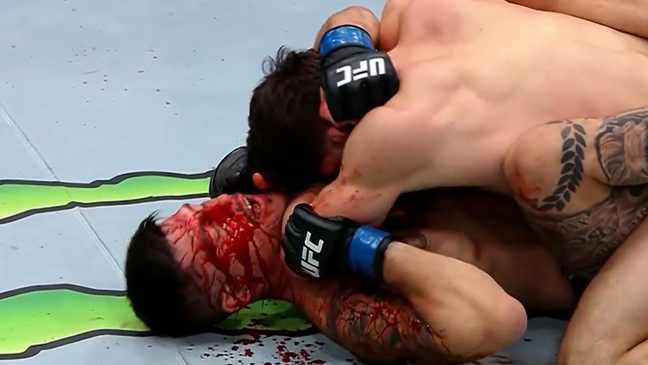 Alvarez's nose was busted right open. Picture: Supplied