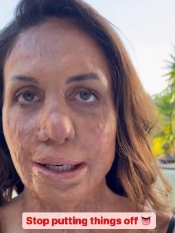 In 2023, Turia Pitt revealed she had a growth removed from her tongue, and urged people to “stop putting things off” when it came to their health.