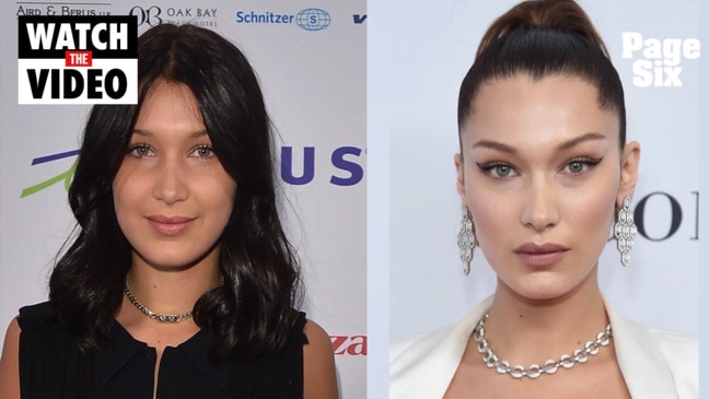 Bella Hadid regrets cosmetic surgery she had as a teenager