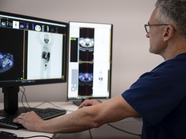 Qscan Hobart will now provide imaging with an advanced prostate cancer diagnostic known as Illuccix ÃÂ® . Picture: Supplied