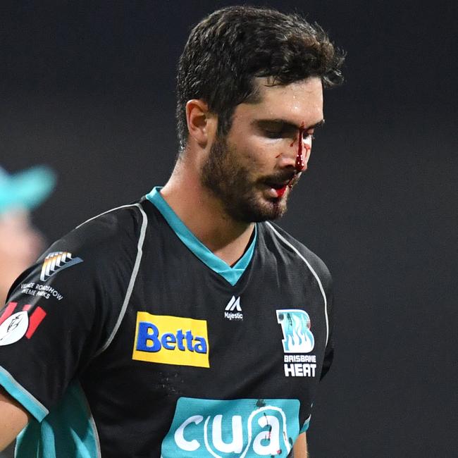 Cutting walks off the field after suffering a facial injury. Picture: AAP