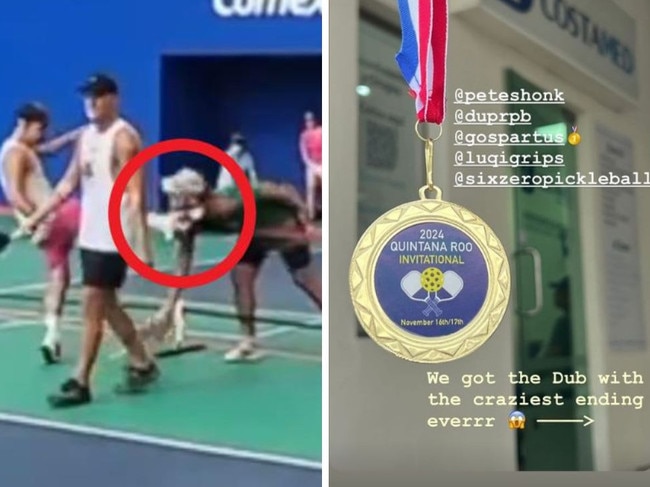 The pickleball player who got kicked in the face has spoken.