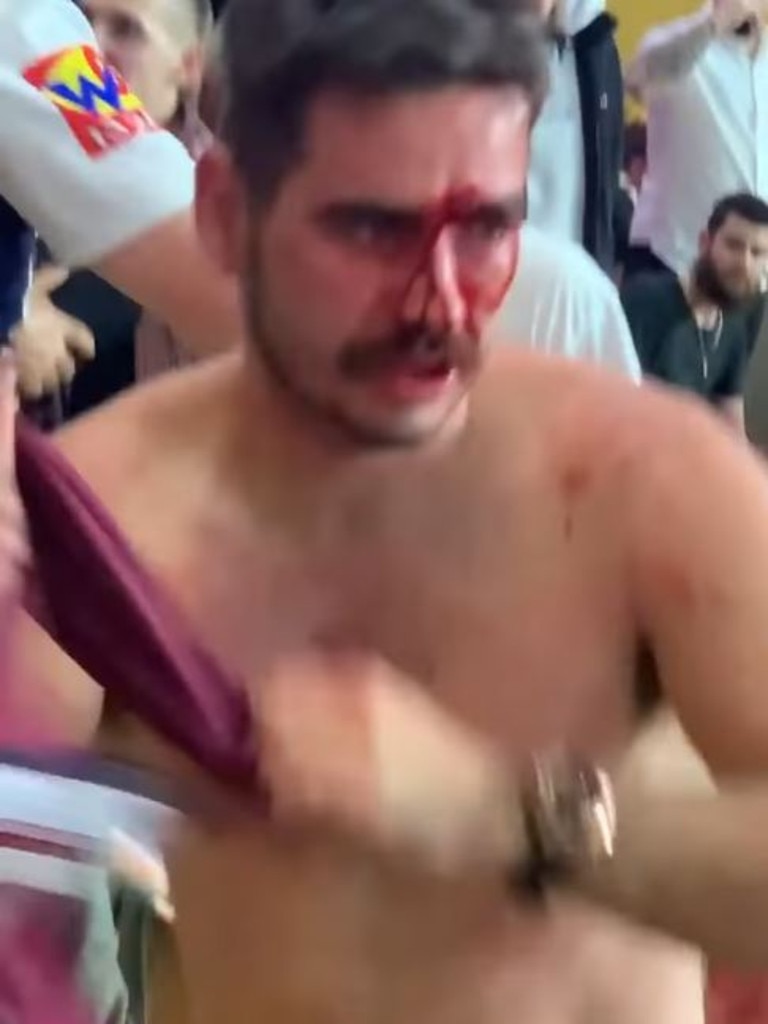 Fans were left bloodied during a crowd brawl on the opening night of Magic Round at Suncorp Stadium