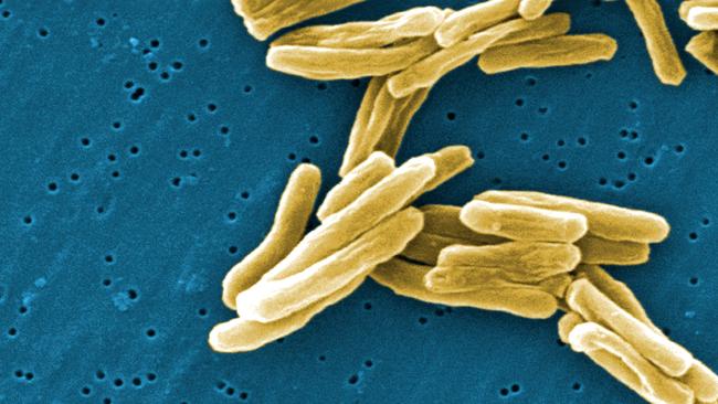 This image shows the Mycobacterium tuberculosis (TB) bacteria in a high magnification. Picture: AP 