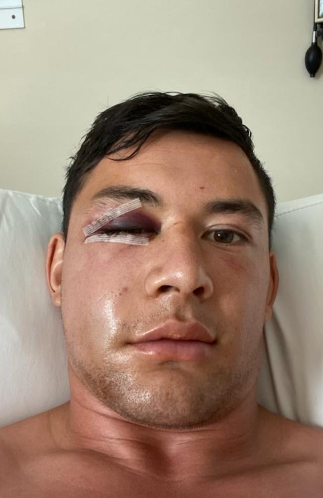 Joey Manu after surgery.