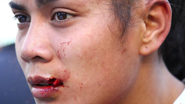 Simaima Taufa bears the damage of her commitment. (Cameron Spencer/Getty Images)