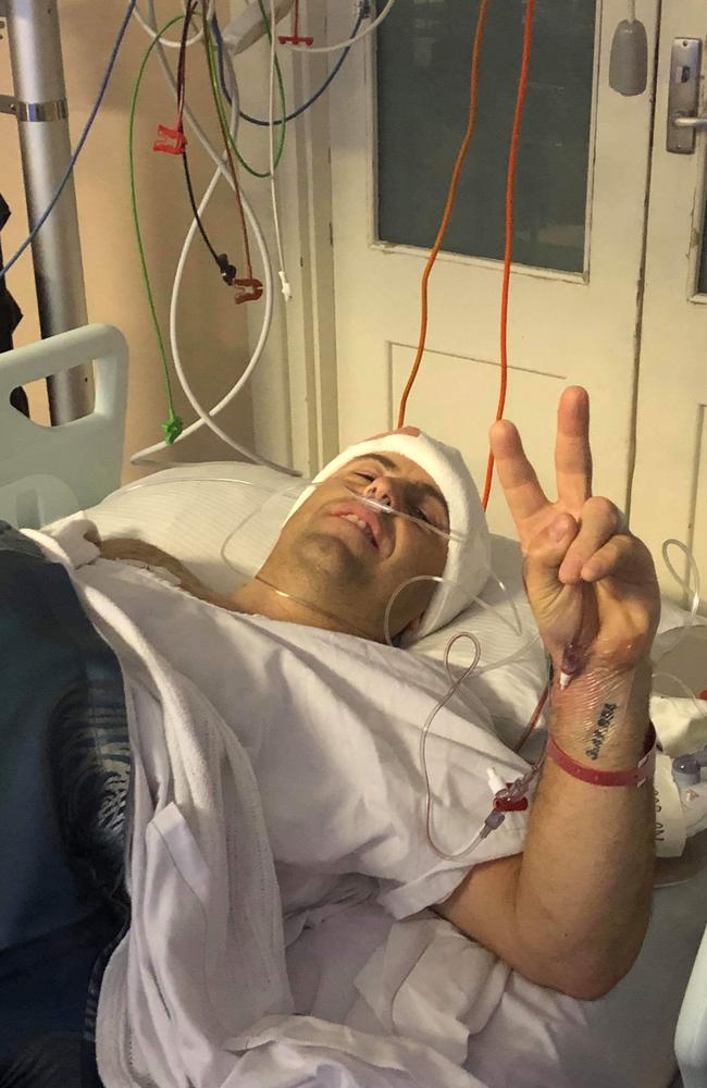 Decker in good spirits following brain surgery last week. Picture: Supplied