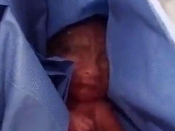 ‘Dead’ newborn found alive in morgue