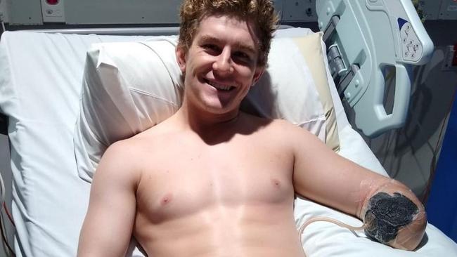 British backpacker Henry Dunn lost his lower left arm after a workplace accident on a remote Northern Territory cattle station.