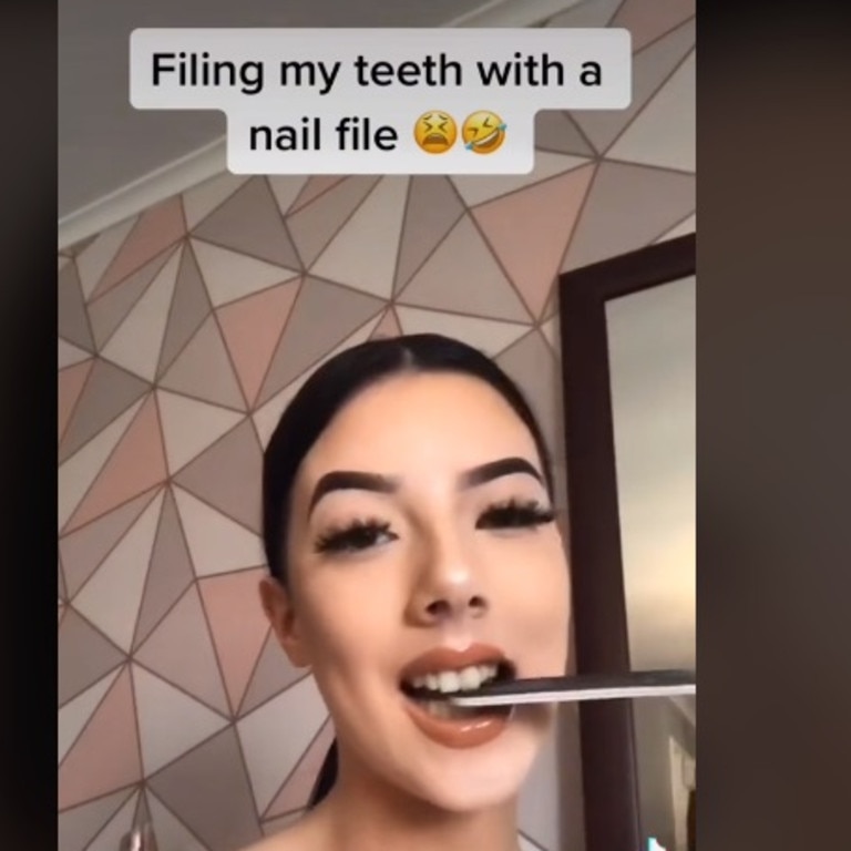 Dental Surgeon Takes Aim At TikTok Teeth Hacks | News.com.au ...