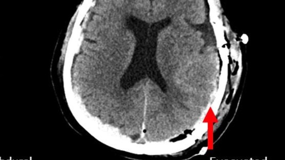 First-ever recording of a dying human brain reveals what happens when we die. Picture: Frontiers in Aging Neuroscience