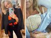 Phoebe Burgess reveals secret boob op