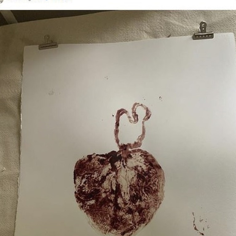 Domino shared a painting of a red uterus after reaching 40 days post-partum