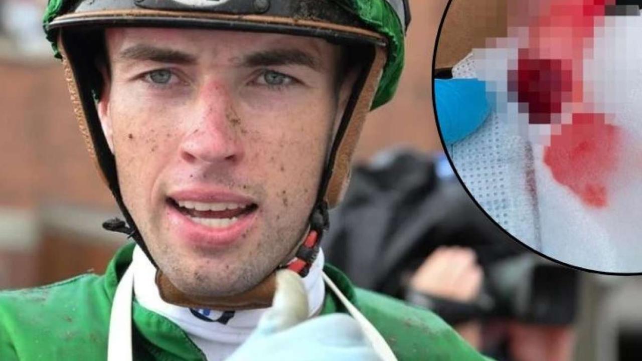 James Orman had the tip of his finger bitten off by a horse on Tuesday morning. Picture: Grant Peters/Trackside Photography.