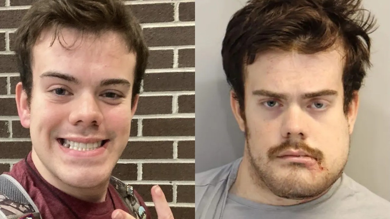 Alleged mass shooter’s face disfigured after cop shot him in jaw