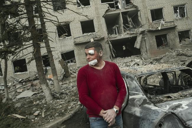 An injured man stands next to his burnt car after a deadly strike in the city of Sloviansk on Monday