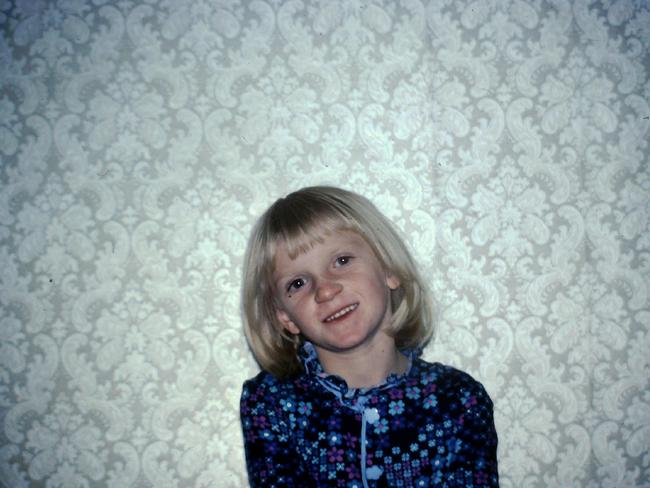 Congenital heart disease survivor Jeanette Manson as a 