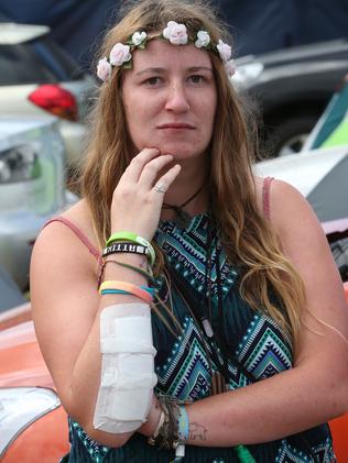 Emily Johnson is a nurse who was injured trying to help people in the crush. Picture: David Crosling