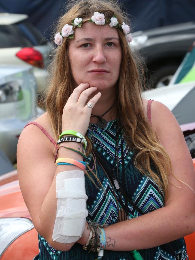 Emily Johnson is a nurse who was injured trying to help people in the crush. Picture: David Crosling
