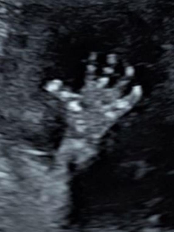 Brant posted this ultrasound photo on Instagram.