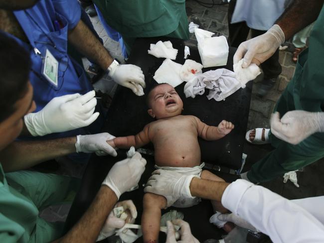 Palestinian medics treat a baby wounded in an missile strike in the southern Gaza strip. AP Photo/Eyad Baba
