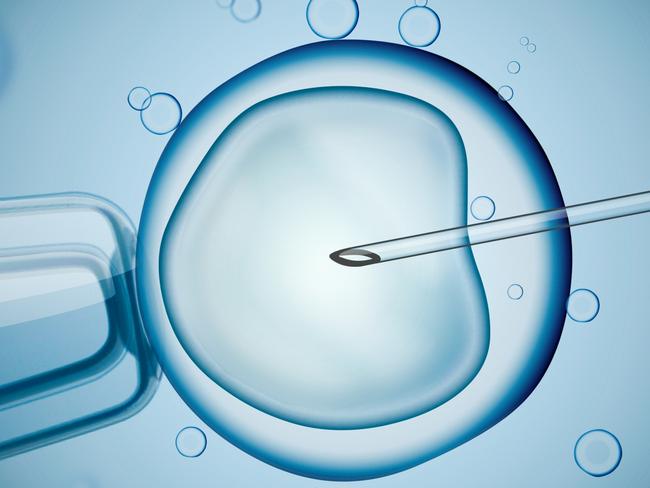 Laboratory microscopic research of IVF (in vitro fertilization). Digital illustration. For Leader group read on IVF. Picture: iSTOCK