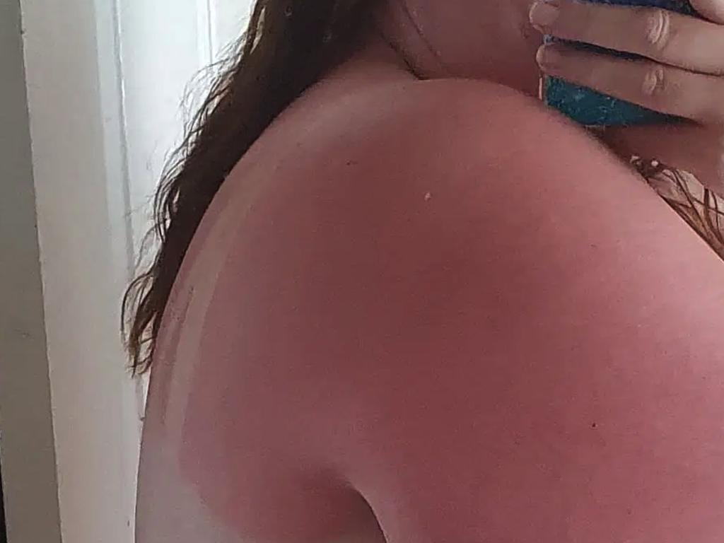 Bet this woman regrets not covering up her shoulders … Picture: Instagram