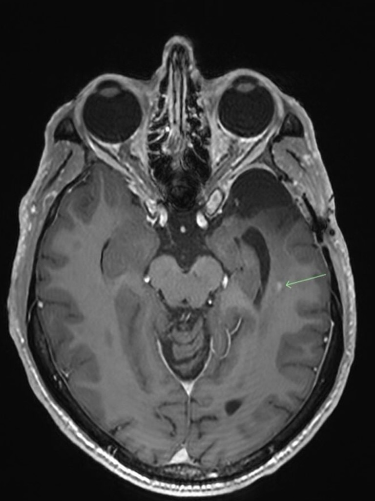 He’s currently trialling a first-of-its-kind treatment – but has just shared the results of a recent MRI scan. Picture: Instagram/profrscolyer