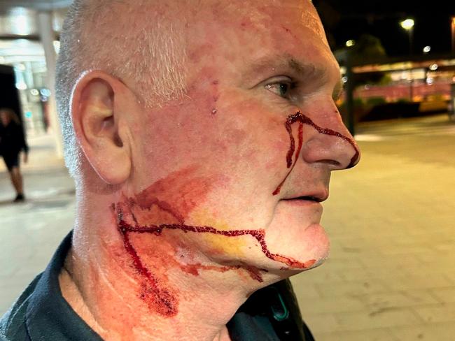 An AFP officer needed hospital treatment after being stabbed in the face and neck with a pen allegedly by a Jetstar passenger in Perth. Picture: Australian Federal Police