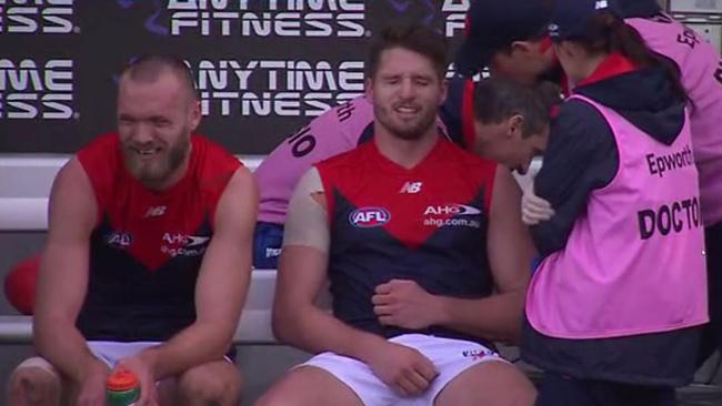 Jesse Hogan cradles a broken collar bone on the bench against North Melbourne in Hobart.