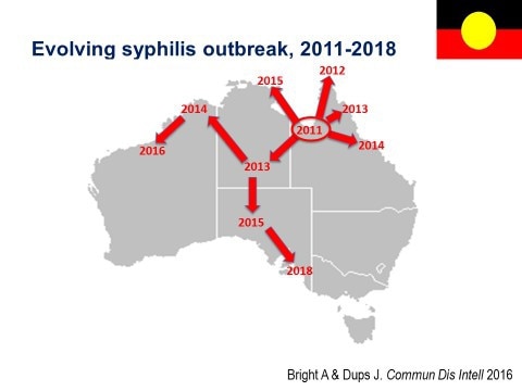 Where the evolving syphilis outbreak began and how it’s grown.