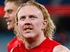 Dons? Cats? Crows? How potential Oliver trade could look
