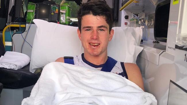 Andrew Brayshaw on his way to hospital after being hit. Picture: Instagram