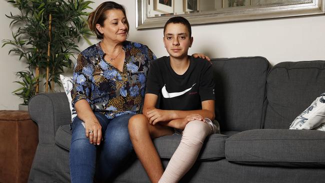 The teenager, now forced to wear a bandage on his leg for a year, advised other children to get help if making the honeycomb. Picture: Tim Hunter