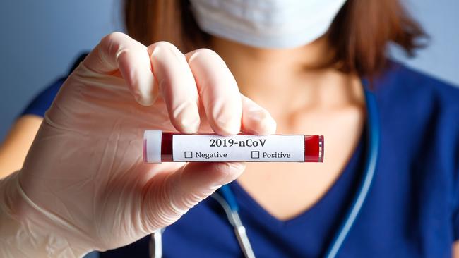 People in the NT who have recently visited a Covid-19 case location in the ACT are now required to get tested and self-isolate until they receive a negative result, following new health directions.