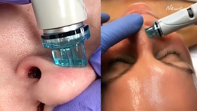 Hydrafacial: The facial beauty treatment performed every 15 seconds