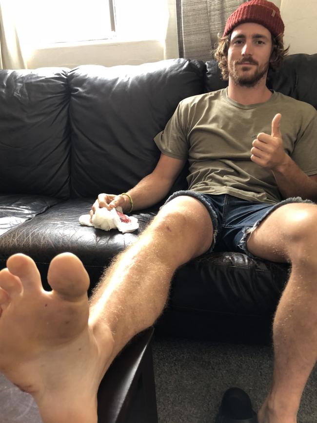 Mike Ruttkowski resting at home after he was bitten by the shark. Picture: Jim O'Rourke